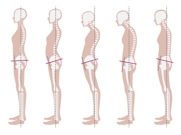 Stand Tall: The Essential Guide on How to Improve Posture and Reduce Pain